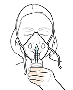 Babaeng lumalanghap ng gamot sa pamamagitan ng nebulizer facemask sa mukha.